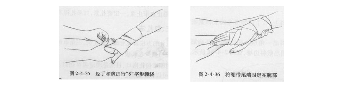 医用绷带8字包扎法-2.jpg