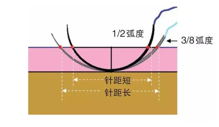 口腔种植选用针型弧度.jpg